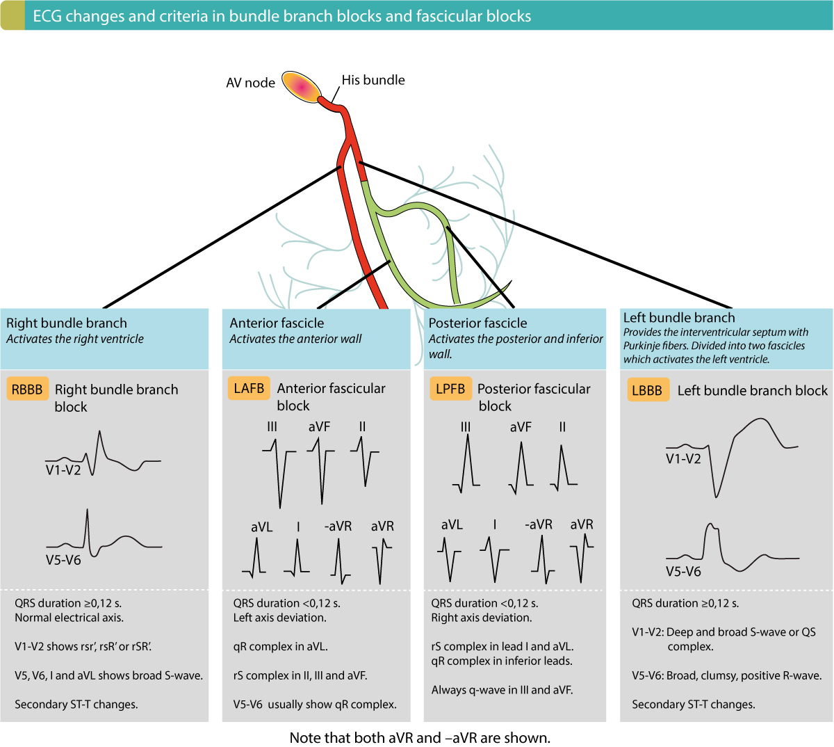 AI-Assisted ECG Analysis