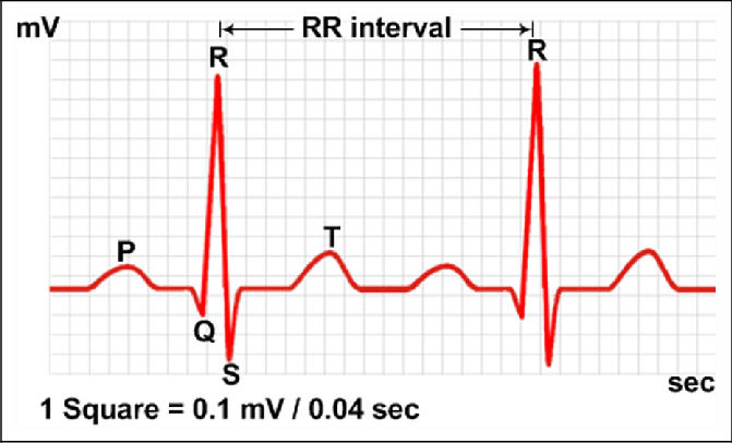 Normal Rr Interval Ekg AI-Assisted ECG Analysis